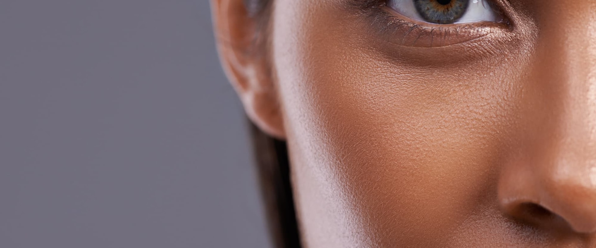 Can Filler Under the Eyes Migrate After Months?