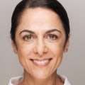 How Much Does Under Eye Filler UK Cost? A Comprehensive Guide
