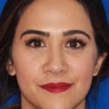What Filler is Best for Under Eye Juvederm Treatments?