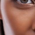 When Does Dermal Filler Settles Under the Eyes?
