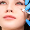 How Long Do Fillers Last Under the Eyes?