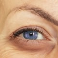Under-eye-fillers